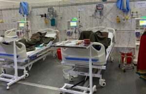 वाशी सार्वजनिक अस्पताल में आधुनिक डायलिसिस की सुविधा
